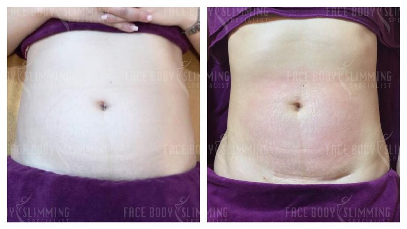 Body slimming example for shaping progress